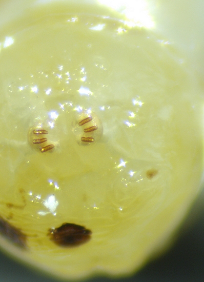 Larve de Ceratitis capitata Wiedemann : stigmates post�rieurs.