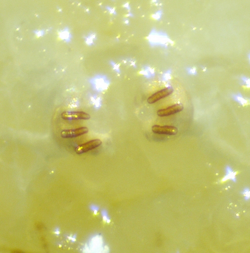 Larve de Ceratitis capitata Wiedemann : stigmates post�rieurs.