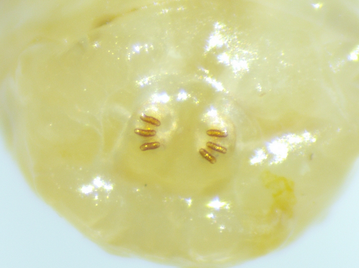 Larve de Ceratitis capitata Wiedemann : stigmates post�rieurs.