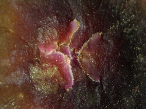 Figue immature rougie (ponte de Silba adipata McAlpine) : �cailles ostiolaires de premier niveau.