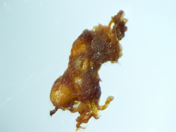 Examen sous st�r�omicroscope d'une masse brun�tre � aspect d'imago  dess�ch�.