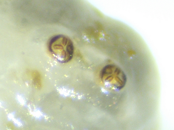 Silba adipata McAlpine : stigmates post�rieurs d'une larve de 6 mm de long.